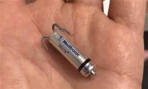 心臟起搏器行業現狀 心臟起搏器市場分析