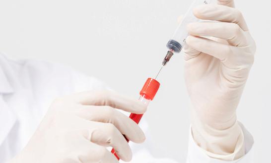 生物科研試劑行業市場調研分析 中國生化試劑行業投資前景預測2023